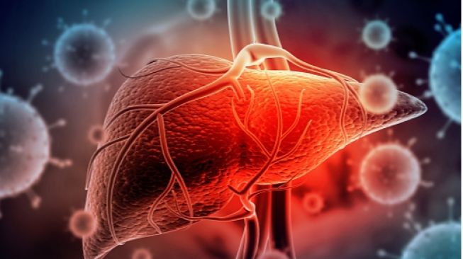 Kenali Hepatitis, Gejala dan Cara Mengobatinya
