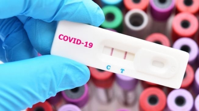 Adik dan Ibu Pengantin Wanita Meninggal Karena Covid-19, 30 Tamu Positif