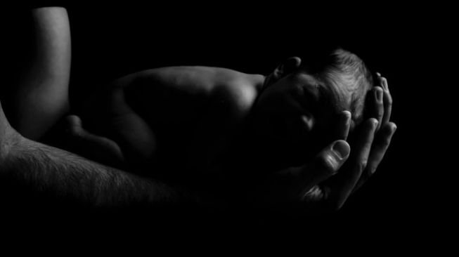Bayi Terkecil di Dunia Seberat Apel Mampu Bertahan Hidup