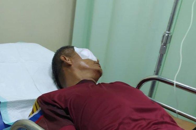 Orangtua Murid Serang Guru di Bengkulu, Matanya Hampir Buta