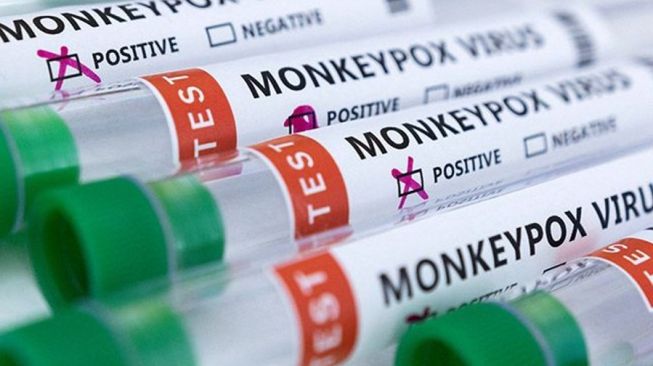 Kemenkes: Kasus Cacar Monyet di Indonesia Terkonfirmasi 7 Orang