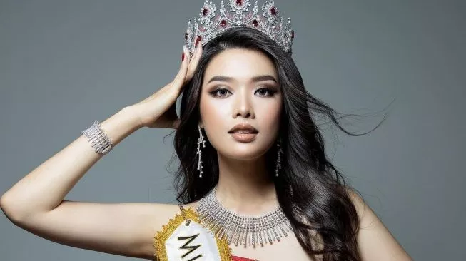 Positif Covid-19, Unggahan Carla Yules Ini Banjir Komentar Dukungan Warganet