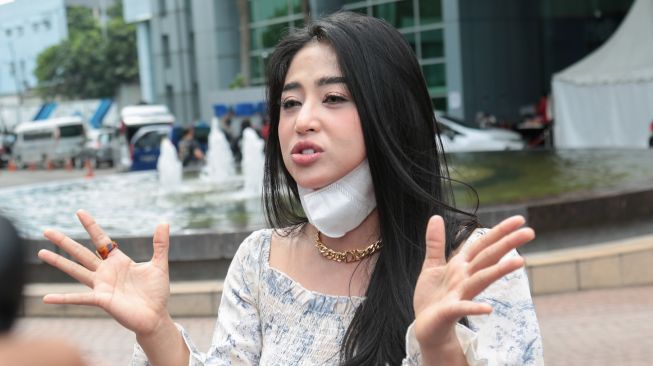 Dewi Perssik Ketahuan Tak Pakai Cincin Nikah
